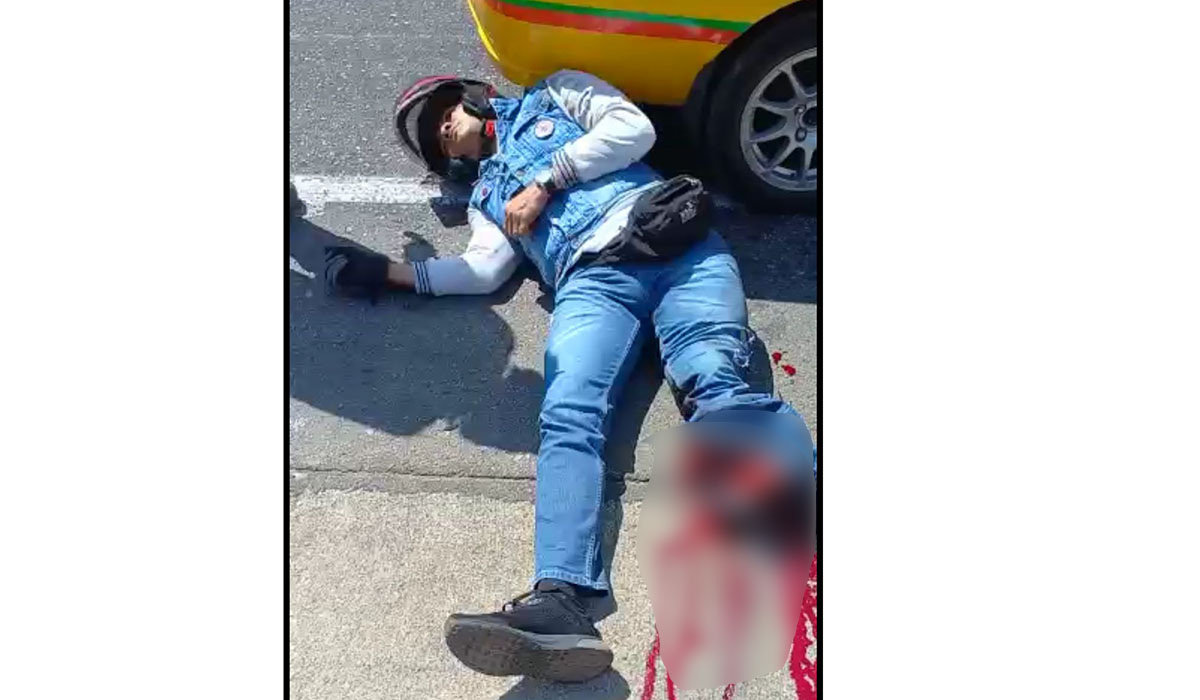 Motociclista se destrozó el pie al chocar contra un camión de basuras
