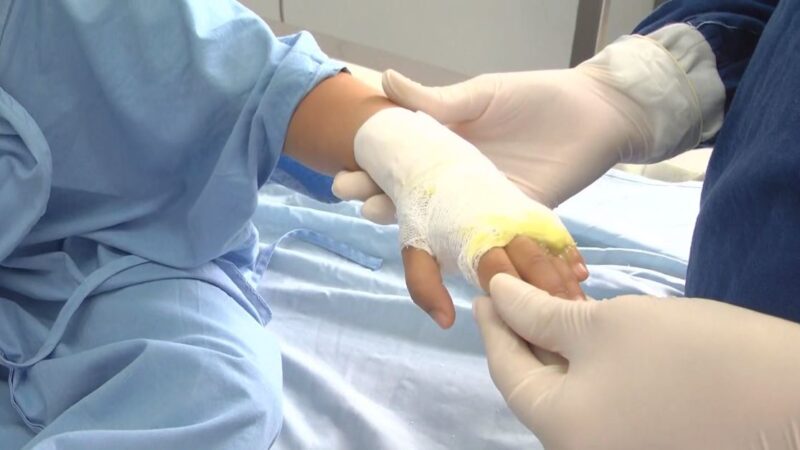 En Aguachica ocurrió primer caso de lesiones por pólvora en el Cesar